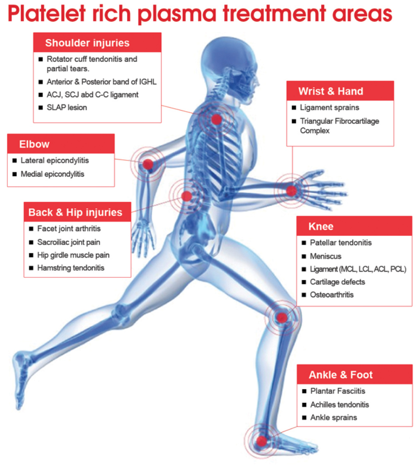 PRP Injections